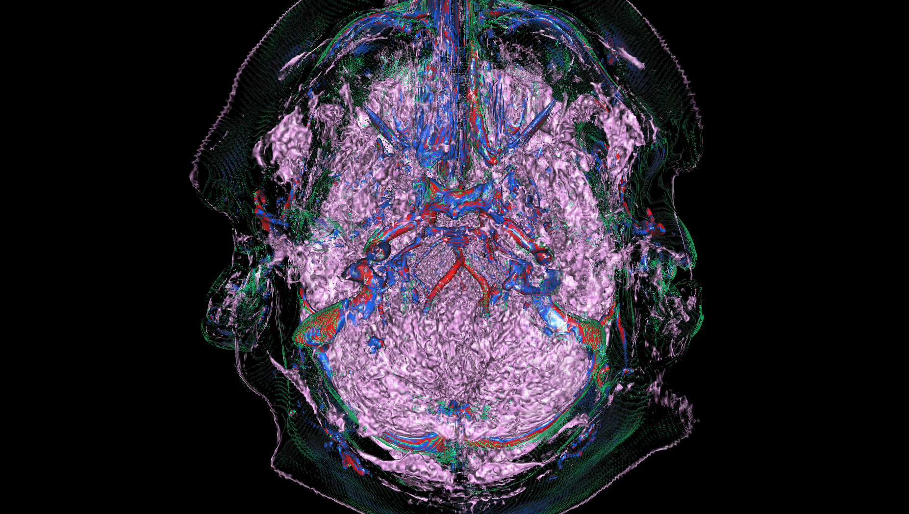 F3_05_BrainRaycasting copy